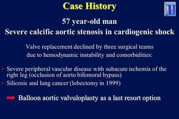 FIM PHV Implantation: case history