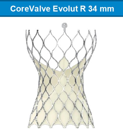 CoreValve Evolut R 34 mm