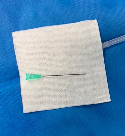 Fine gauge needle (e.g. 21 gauge) of adequate length (e.g. 4 cm/1.5 in)