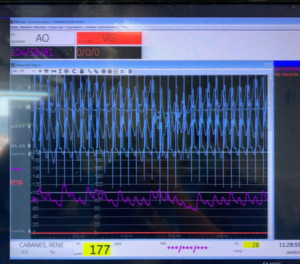 Testing pacing response