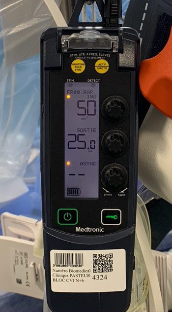 Testing pacing response