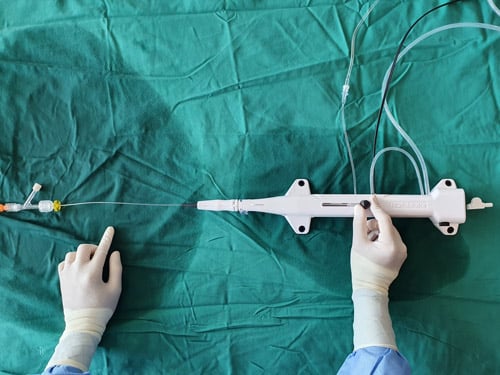 The burr is advanced beyond the guiding catheter and proximal to the lesion. 