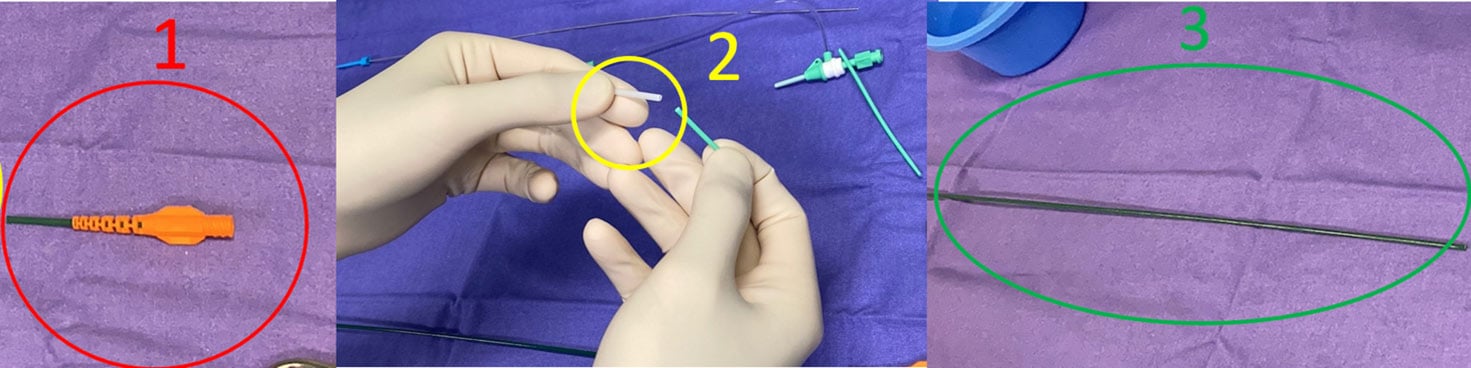 image5a-i-need-shorter-guiding-catheter-and-have-it-in-my-cath-lab-three-segments-to-build-the-new-gc