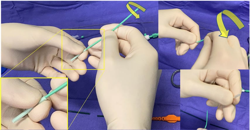 image5b-i-need-shorter-guiding-catheter-and-have-it-in-my-cath-lab-using-rigid-sheath-of-the-introducer-like-a-stick