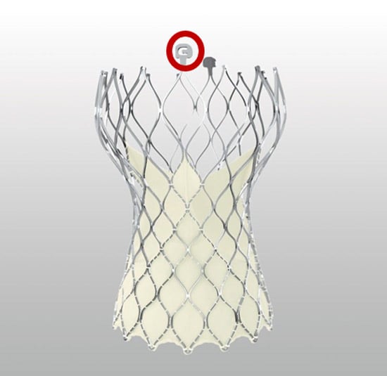 Figure 5: The C-paddle of the Evolut platform (red circle) always corresponds to one of the three commissures