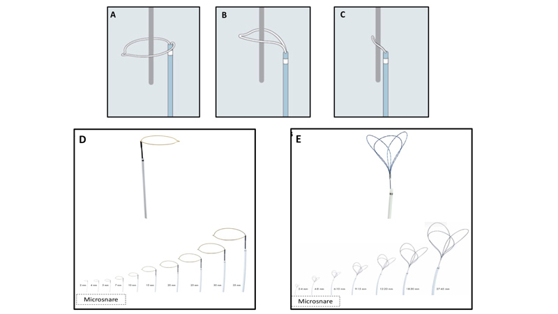 Figure 1 - How a snare works (A-C).  A)Snare catheter in the extended configuration (flowered out); B) Once the capturable body is inside the loop, the snare is tightened; C) The foreigner body is secured by the snare and is ready to be retrieved. Different types of snare (with different dimensions) (D-E). D) Single-loop snare; E) Multi-loops snare.