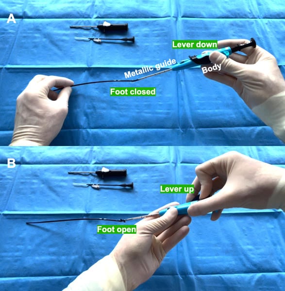 Figure 1: A) Main components of the Prostyle device. B) Illustration demonstrating the raising of the lever resulting in foot opening.