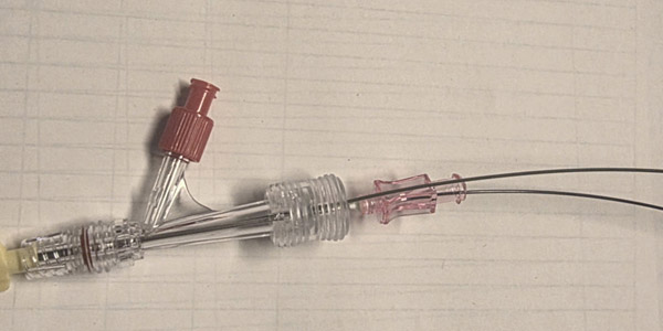 The setup is a Y-Piece with the 2 wires in place (polymeric straight wire inside the needle, the 0.035 wire with the hard end outside)