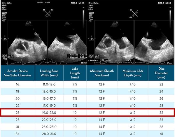 Wie sollte ich einen Patienten mit unzureichendem chirurgischen Verschluss des linken Vorhofohrs behandeln - Abbildung 2