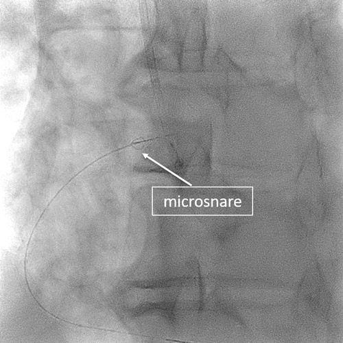 Microsnare