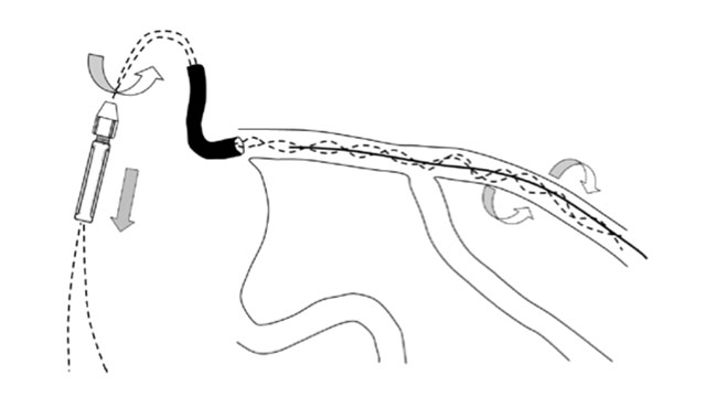 Illustration: GW multiwire technique