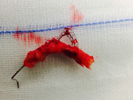Surgery