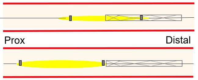 Lost scaffold on wire