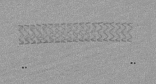 Radiopacity scaffolds