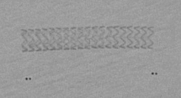 Radiopacity scaffolds