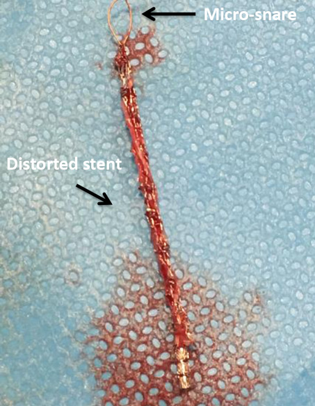 Figure 10.1.