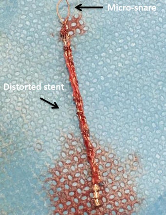 Figure 10.1.
