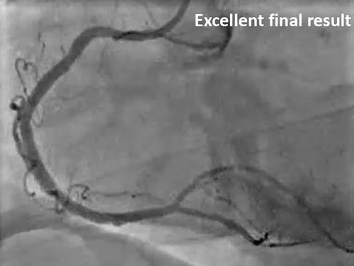 Figure 8.2. Final result
