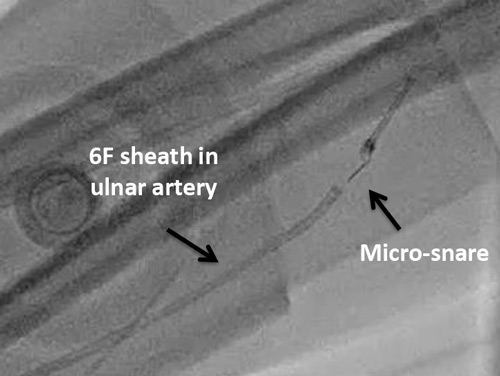 Figure 9.1.