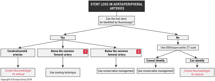 Stent loss in aorta/peripheral circulation