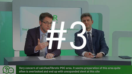Step by step planning and performing a bifurcation: PCI requiring 2 stents upfront
