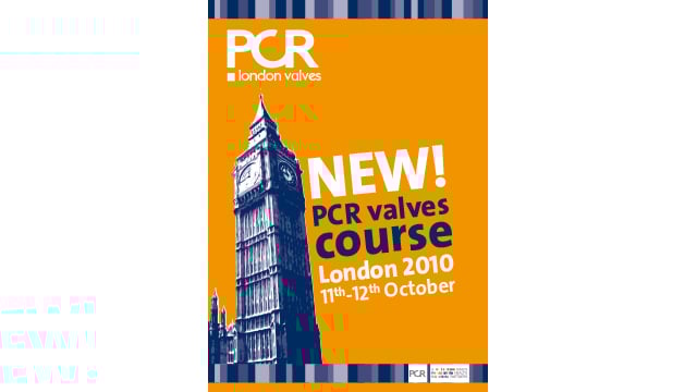 Daily Wire of PCR London Valves 
