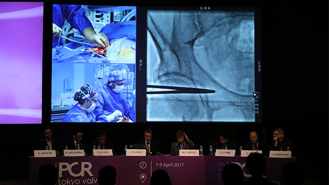 Don't miss a PCR LIVE session