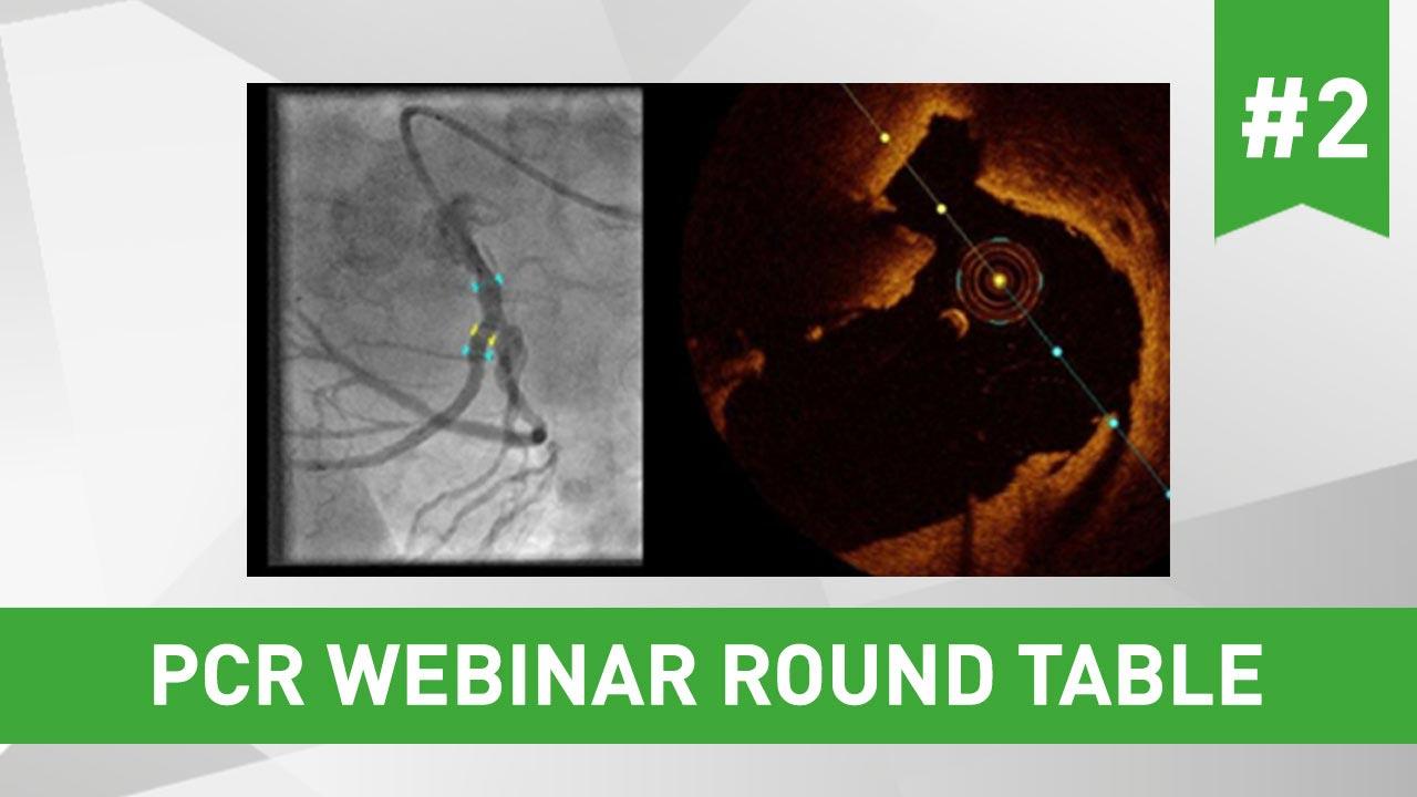 Imaging and functional guidance for left main and bifurcation PCI