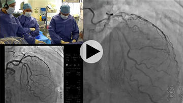 PCR Webinar Bifurcation saison 1