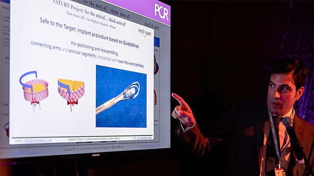 Presentation of an innovation at PCR Innovators Day