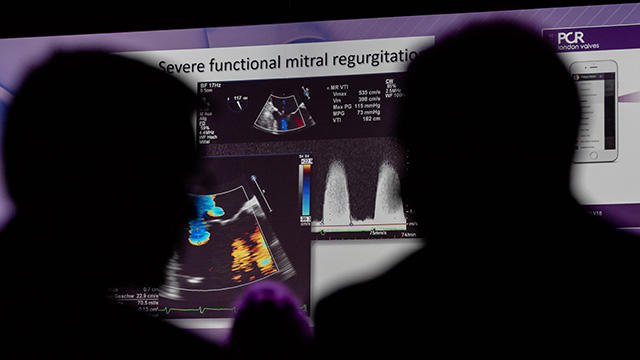 MiTRAL session at PCR London Valves 2019