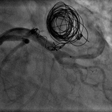 EuroPCR 2015: an image is worth 1000 words - Image 09