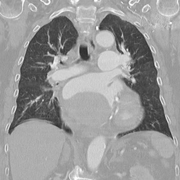 Just an ordinary PCI