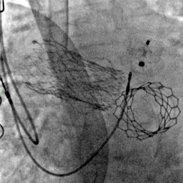 In the service of cardiology for 20 years