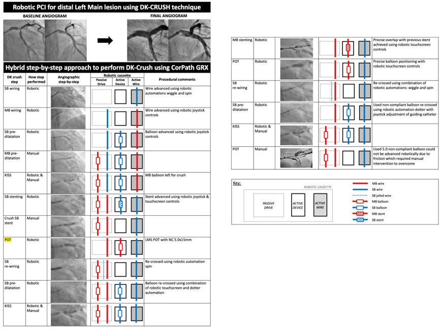Step-by-step workflow demonstrating how to perform each of the recommended steps of a DK crush PCI, whilst managing the exchange of wires (solid lines), balloons (open box) and stents (crossed box) for both the main branch (red) and side branch (blue).
