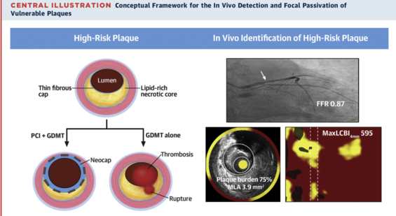 Conceptual framework for the in vivo detection and focal passivation of vulnerable plaques
