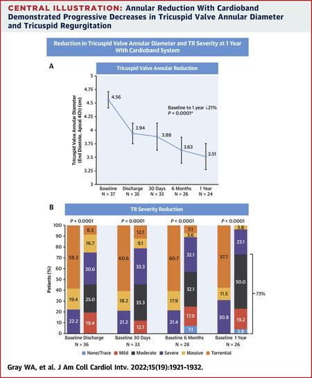 Annular reduction with Cardioband demonstrated progressive decreases in tricuspid valve annular diameter and tricuspid regurgitation