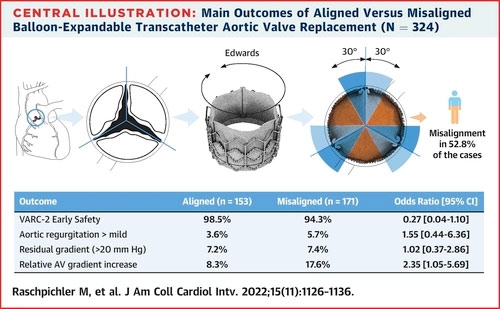 main-outcomes-of-aligned-versus-misaligned-balloon-expandable-transcathteter-aortic-valve-replacement