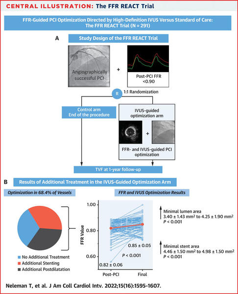 PCR_FFR_REACT_Trial