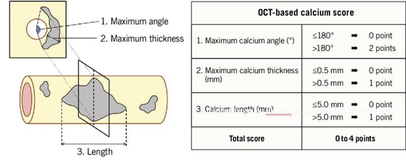Figure 1. OCT-derived calcium score - Adapted from A. Fujino, et al. Eurointervention 2018