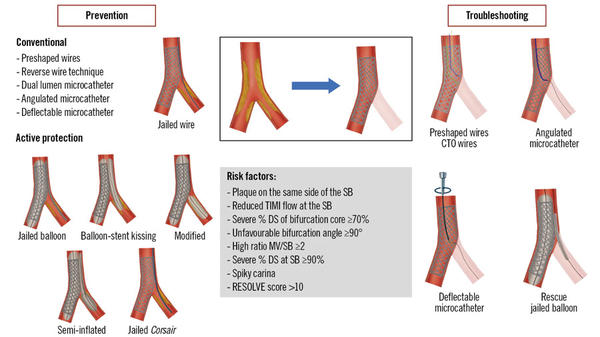 Central illustration: Preserving SB access during provisional stenting. CTO: chronic total occlusion; DS: diameter stenosis; MV: main vessel; RESOLVE: Risk prEdiction of Side branch OccLusion in coronary bifurcation intervention; SB: side branch; TIMI: Thrombolysis in Myocardial Infarction.