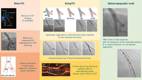 PCI for bifurcation coronary lesions using optimised angiographic guidance: the 18th Consensus Document from the EBC - Figure 1