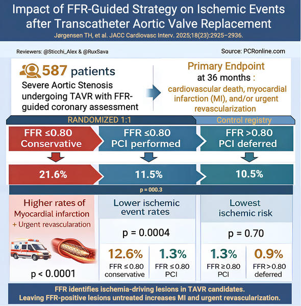 Fractional flow reserve to guide revascularisation in patients with coronary artery disease undergoing TAVR