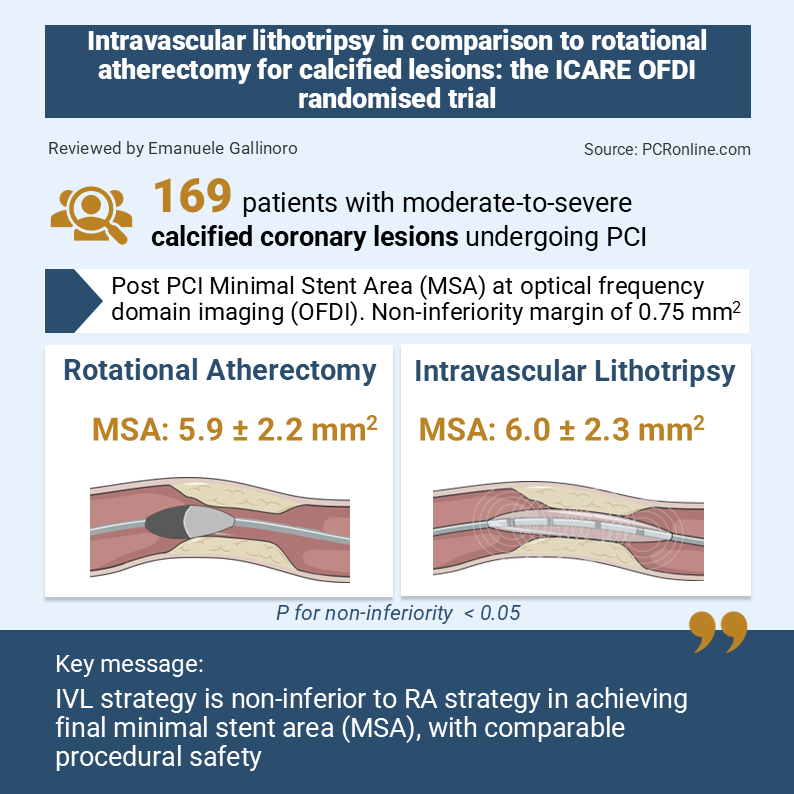 ICARE OFDI IVL vs rotational atherectomy for calcified lesions