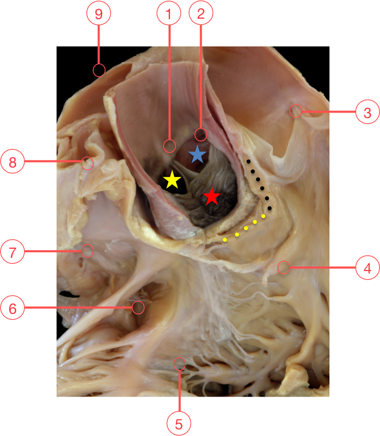 aortic root anatomy