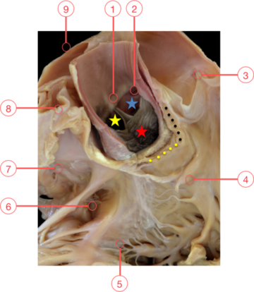 Figure 2. The aortic root