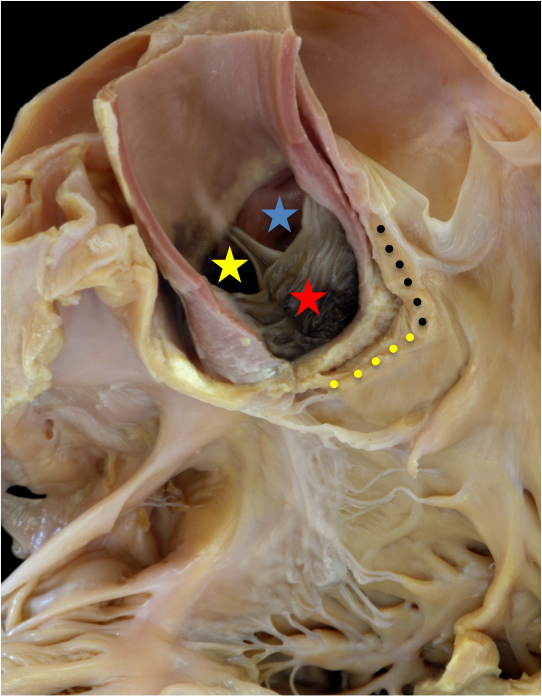 Figure 2. The aortic root