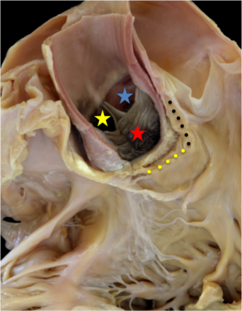 Figure 2. The aortic root