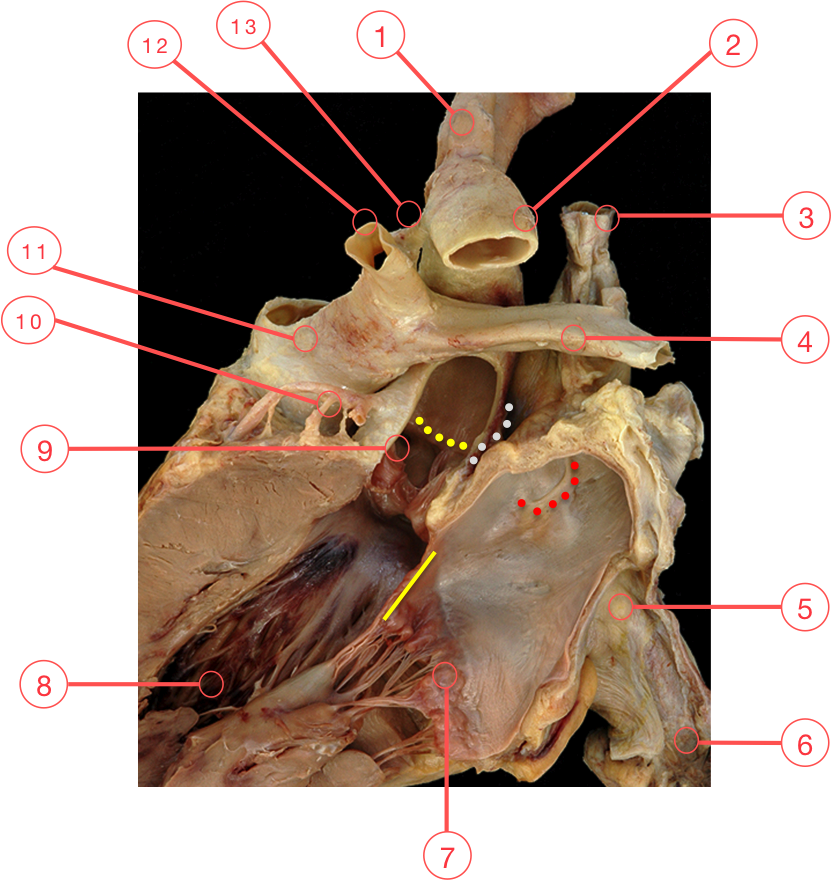 Figure 1. The aortic root