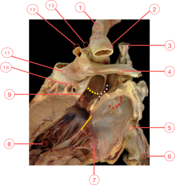 Figure 1. The aortic root